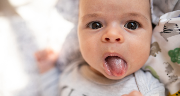 baby tongue ties