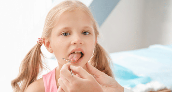 Child receiving myofunctional therapy for tongue tie