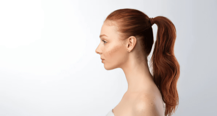 Difference Between Mewing And Myofunctional Therapy
